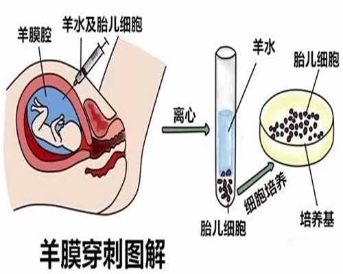 去香港验血做鉴定费用是多少钱,多年难孕难育夫妻进行辅助生殖助孕