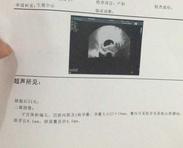 微信联系的香港验血靠谱吗,做试管婴儿解冻6年前冻坯胎，“双胞胎”相差6岁