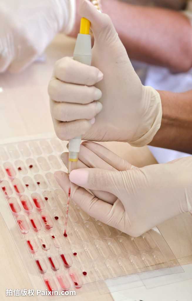香港验血男女去哪个医院,定心的DNA检测办法正规资质