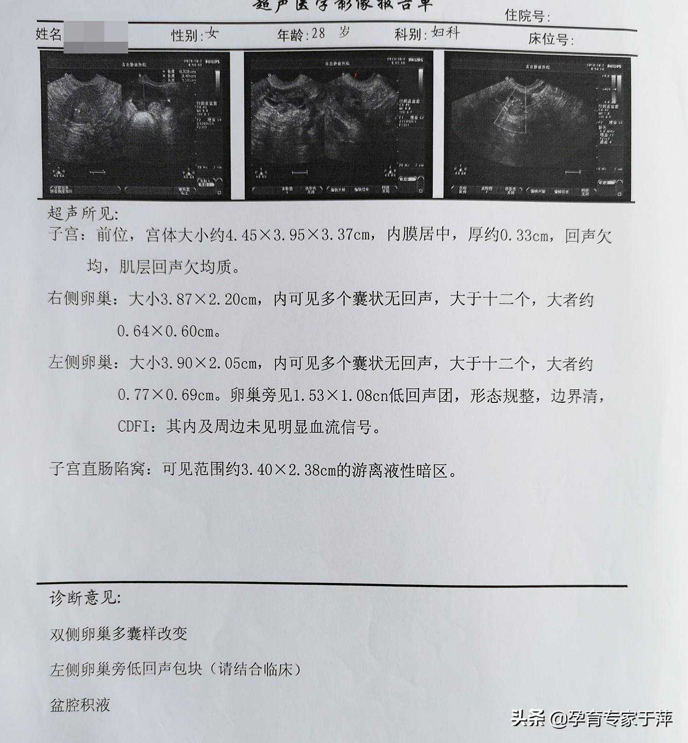 香港邮寄验血鉴定男女准不准,美国试管婴儿技术，科学助孕的5大关键