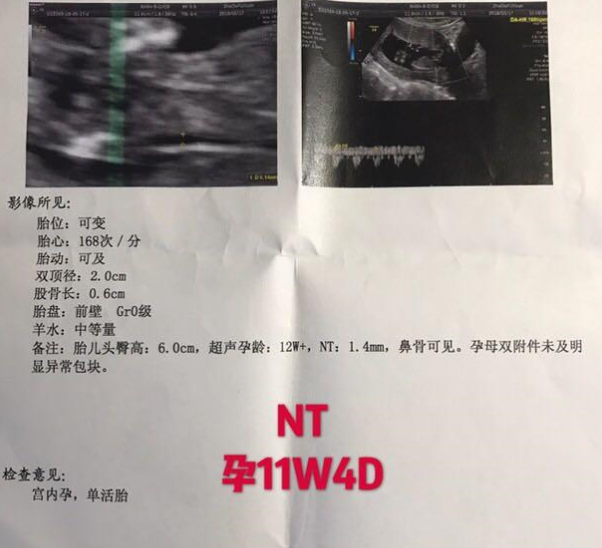 香港医院验血怎么预约,备孕：经历了翻倍乌龙后，我的经验小结